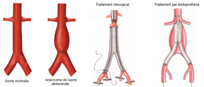 Docteur Francoise Lefebvre Chirurgie Vasculaire Endovasculaire Cliniques De L Europe Bruxelles